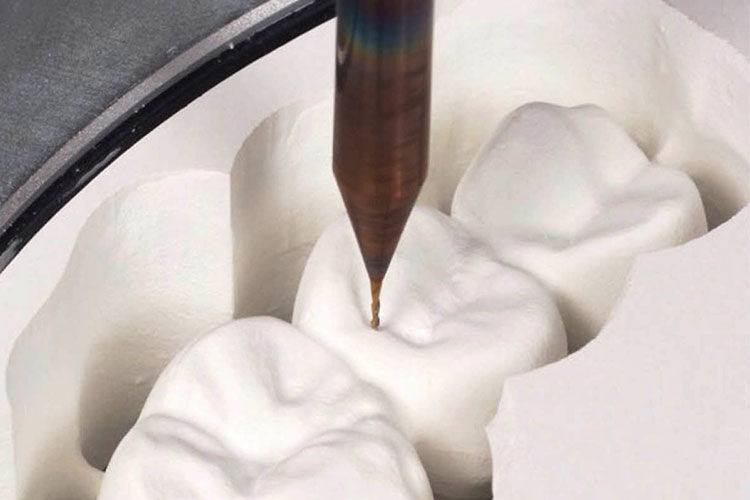 Becker Dental Lab thumbnail