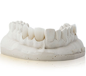 Dental milling materials sample 2