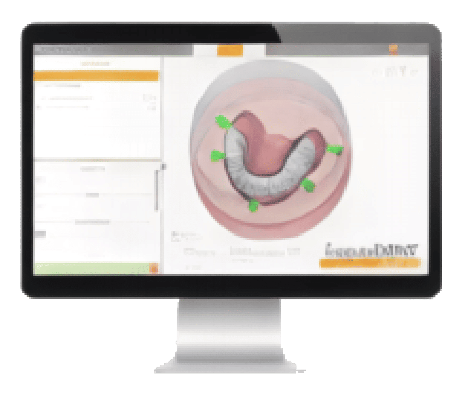 Elevate hyperDENT CAM software