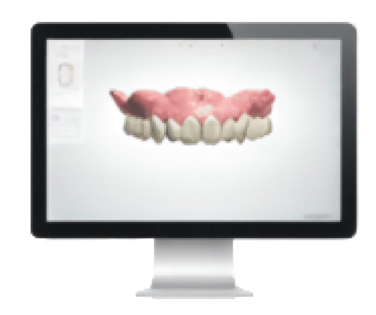 exocad denture preview