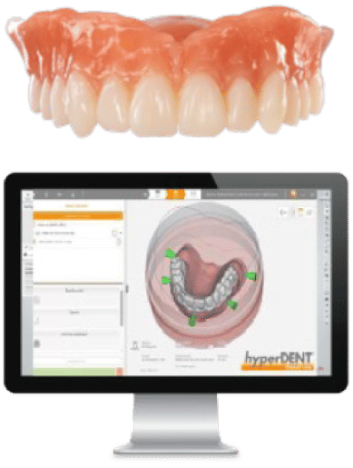 hyperDENT software interface